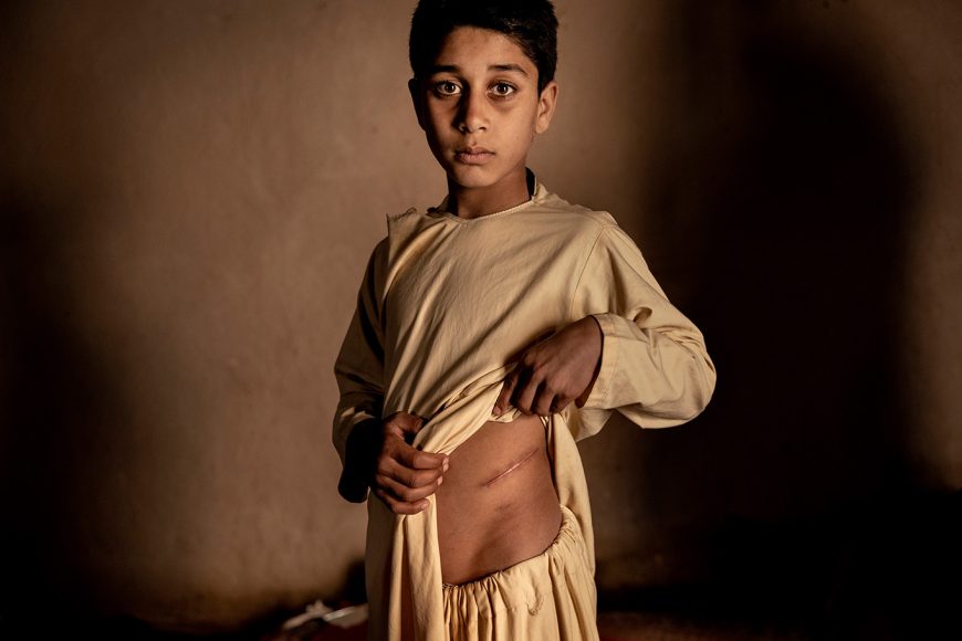 WORLD PRESS PHOTO STORY OF THE YEAR | The Price of Peace in Afghanistan | Mads Nissen, Denmark, Politiken/Panos